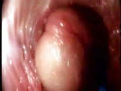 FreeKiloSex presents: Video from the inside of a vagina... very interesting